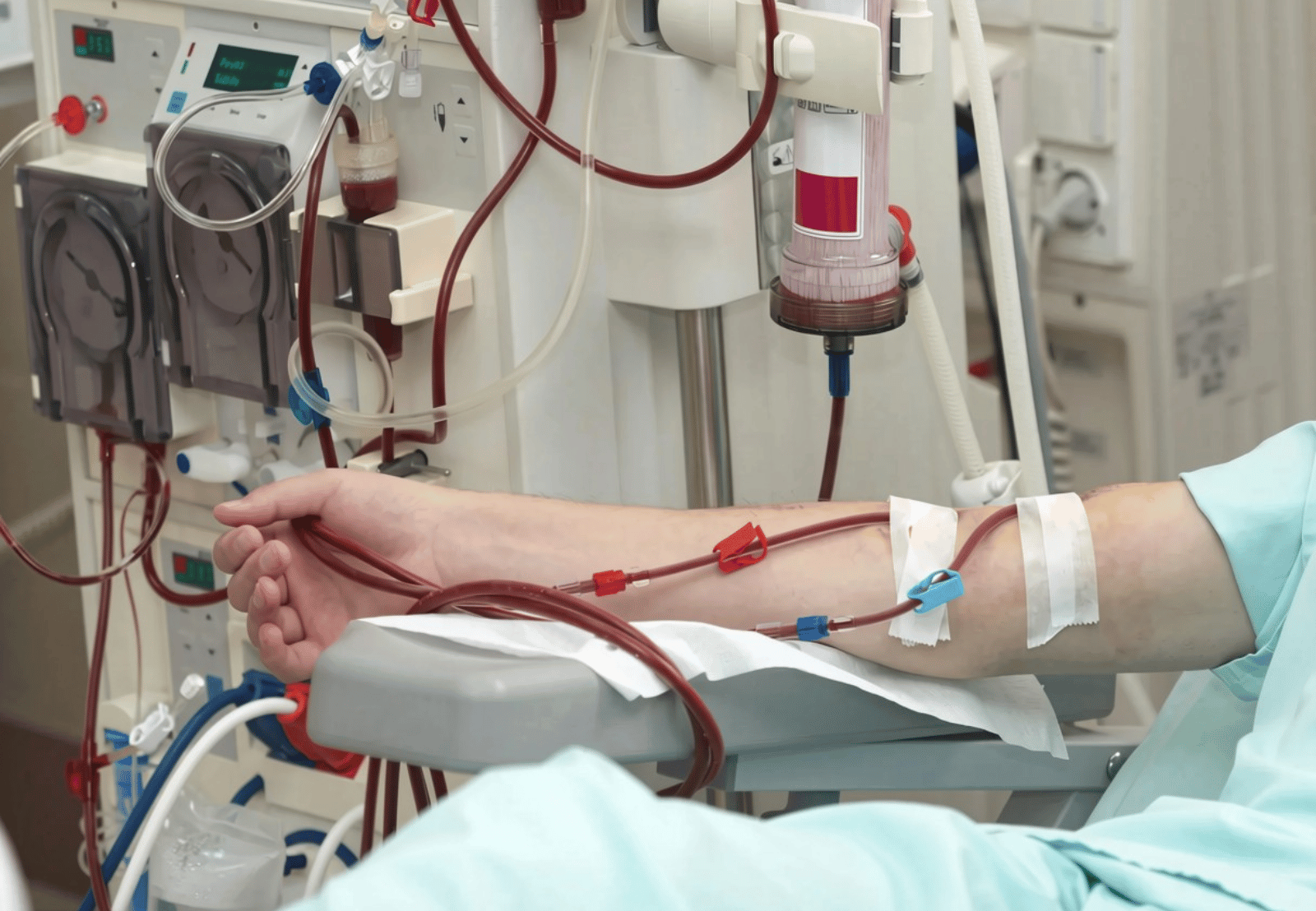 Dialysis Appointments